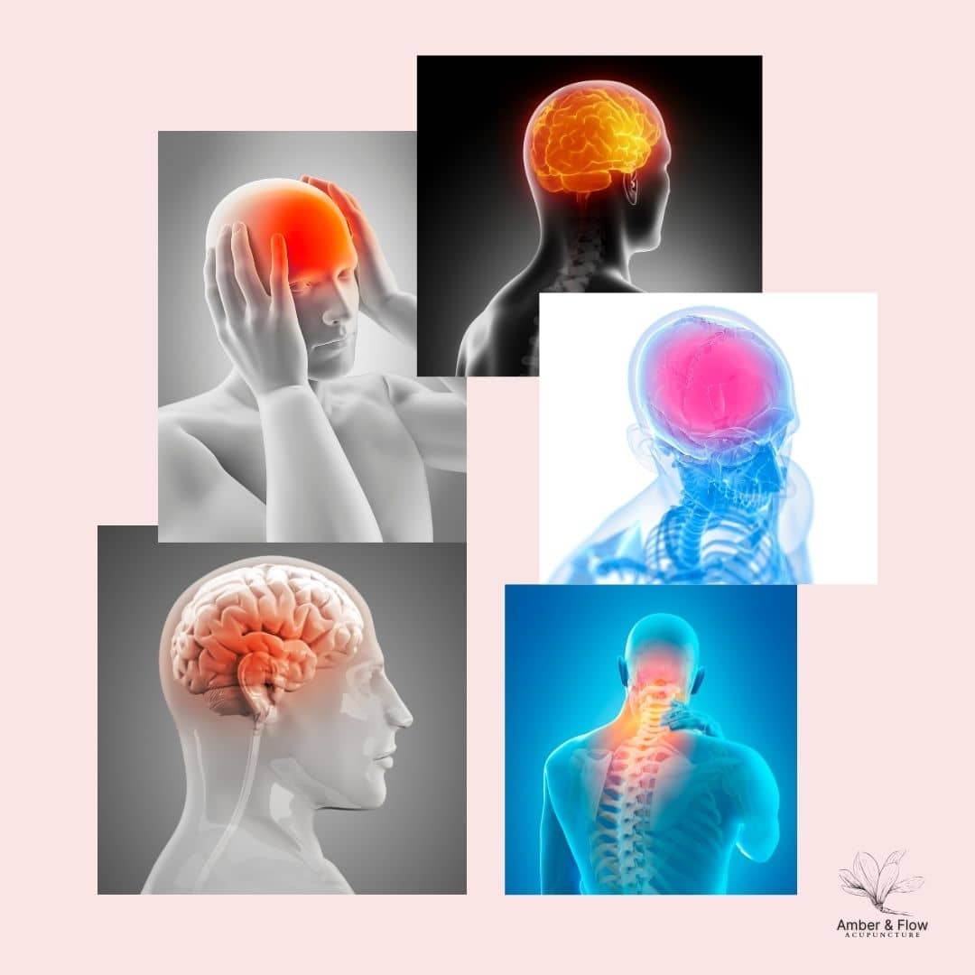 Read more about the article Headache