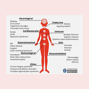 Read more about the article Migraine